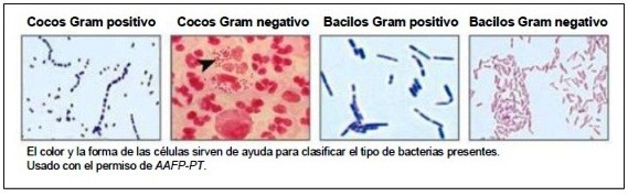 Resultado de imagen de bacterias gram negativas microscopio